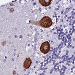 EEF1G Antibody in Immunohistochemistry (IHC)