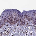 NIPBL Antibody in Immunohistochemistry (Paraffin) (IHC (P))