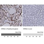NPM2 Antibody in Immunohistochemistry (IHC)