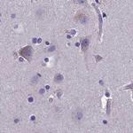AMDHD2 Antibody in Immunohistochemistry (IHC)
