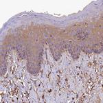 SOD3 Antibody in Immunohistochemistry (IHC)