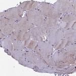 CIAPIN1 Antibody in Immunohistochemistry (Paraffin) (IHC (P))