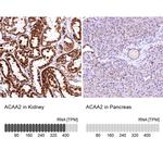 ACAA2 Antibody