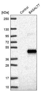 B4GALT7 Antibody in Western Blot (WB)