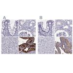 SEMG1 Antibody in Immunohistochemistry (IHC)