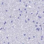 TEX101 Antibody in Immunohistochemistry (IHC)