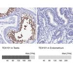 TEX101 Antibody