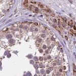 DUS2L Antibody in Immunohistochemistry (IHC)