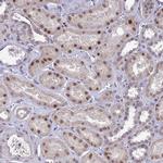 POP4 Antibody in Immunohistochemistry (IHC)