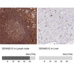DENND1C Antibody in Immunohistochemistry (IHC)