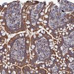 Aquaporin 11 Antibody in Immunohistochemistry (Paraffin) (IHC (P))