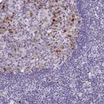 NUSAP1 Antibody in Immunohistochemistry (IHC)
