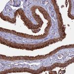 ENTH Antibody in Immunohistochemistry (Paraffin) (IHC (P))