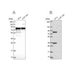 ENTH Antibody in Western Blot (WB)