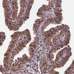 CABIN1 Antibody in Immunohistochemistry (Paraffin) (IHC (P))