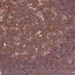 ATXN2L Antibody in Immunohistochemistry (Paraffin) (IHC (P))