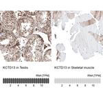 KCTD13 Antibody