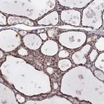 PAGR1 Antibody in Immunohistochemistry (IHC)