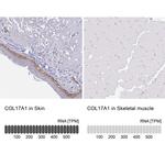 COL17A1 Antibody in Immunohistochemistry (IHC)