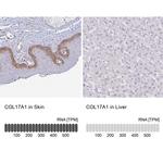 COL17A1 Antibody