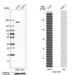 COL17A1 Antibody in Western Blot (WB)