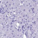 MZB1 Antibody in Immunohistochemistry (IHC)