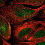 VWCE Antibody in Immunocytochemistry (ICC/IF)