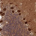 ABH1 Antibody in Immunohistochemistry (Paraffin) (IHC (P))