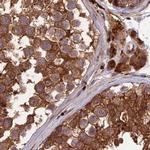 MKKS Antibody in Immunohistochemistry (IHC)