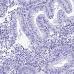 PNMA5 Antibody in Immunohistochemistry (IHC)