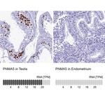 PNMA5 Antibody