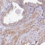 GLRA4 Antibody in Immunohistochemistry (IHC)