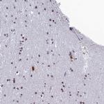 RSRC1 Antibody in Immunohistochemistry (IHC)