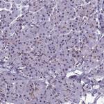 RSRC1 Antibody in Immunohistochemistry (IHC)