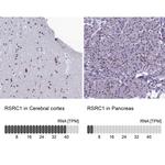 RSRC1 Antibody