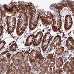 LSM6 Antibody in Immunohistochemistry (IHC)