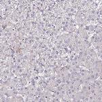 ALDH3B2 Antibody in Immunohistochemistry (IHC)