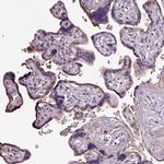 HTRA4 Antibody in Immunohistochemistry (IHC)