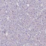 HTRA4 Antibody in Immunohistochemistry (IHC)