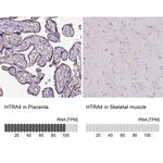 HTRA4 Antibody