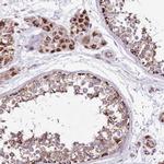 HECTD4 Antibody in Immunohistochemistry (IHC)