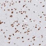 GBP3 Antibody in Immunohistochemistry (Paraffin) (IHC (P))