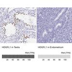 HDGFL1 Antibody in Immunohistochemistry (IHC)