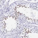 HDGFL1 Antibody in Immunohistochemistry (IHC)