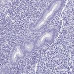 HDGFL1 Antibody in Immunohistochemistry (IHC)