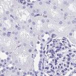 HDGFL1 Antibody in Immunohistochemistry (IHC)