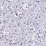 HDGFL1 Antibody in Immunohistochemistry (IHC)