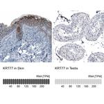 KRT77 Antibody