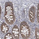 COQ10B Antibody in Immunohistochemistry (Paraffin) (IHC (P))