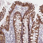 C6orf223 Antibody in Immunohistochemistry (Paraffin) (IHC (P))